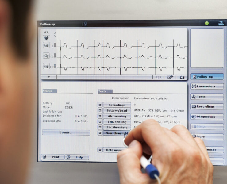 Closeup of programming a cardiac device